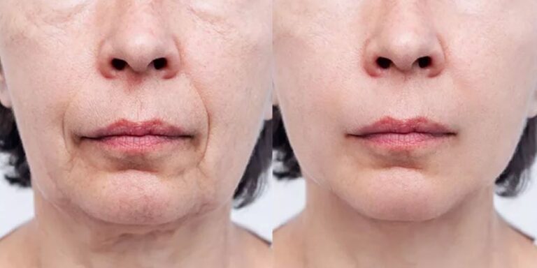 Colágeno Caseiro: Fortaleça Seus Ossos e Alivie Dores nas Juntas. Experimente a receita de colágeno caseiro e sinta a diferença!