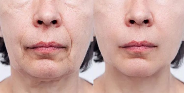 Colágeno Caseiro: Fortaleça Seus Ossos e Alivie Dores nas Juntas. Experimente a receita de colágeno caseiro e sinta a diferença!